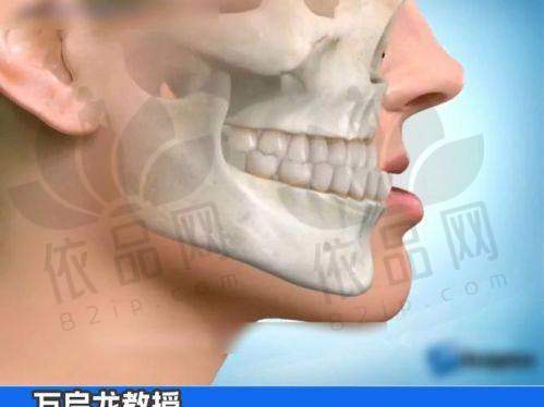 一、北京八大处正颌手术的价格