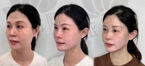 南京华美冯杰：微整型领域的实力派