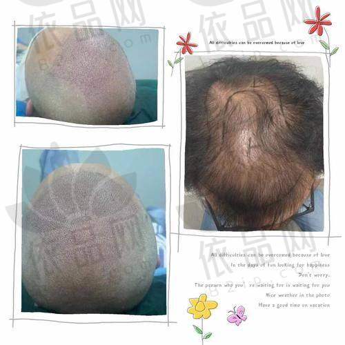 沈阳牛大夫植发医疗美容诊所正规吗