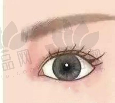 郑州东方整形贺洁外眼角修复2万元起，显微无痕消肿快，闭眼无痕率高！