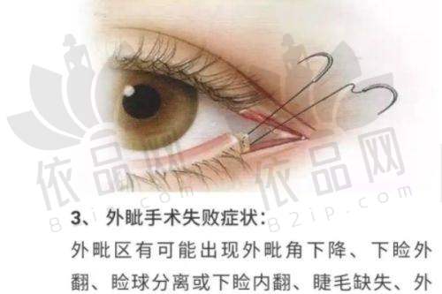 总结