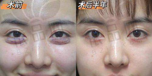 与其他医院对比：优势明显