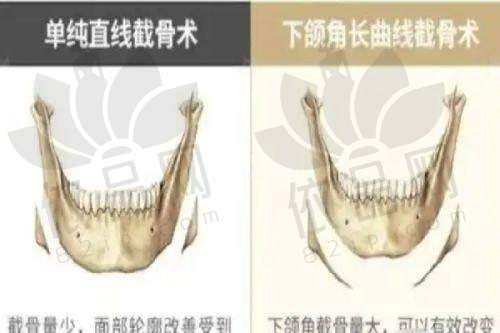 4、广州广美美雅医疗美容门诊部