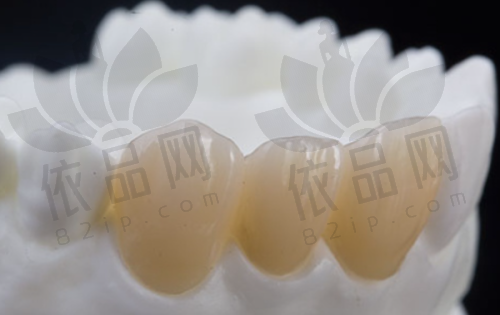 5. 拔牙价格
