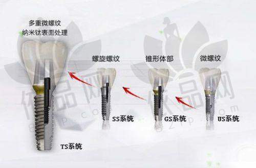 沈阳德易口腔阎奇医生——医生的口碑评价