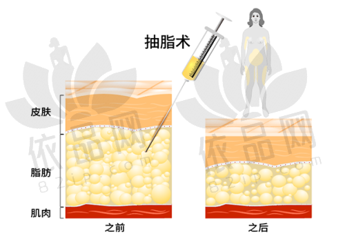 武汉五洲整形医院具备正规资质，3 级实力稳固