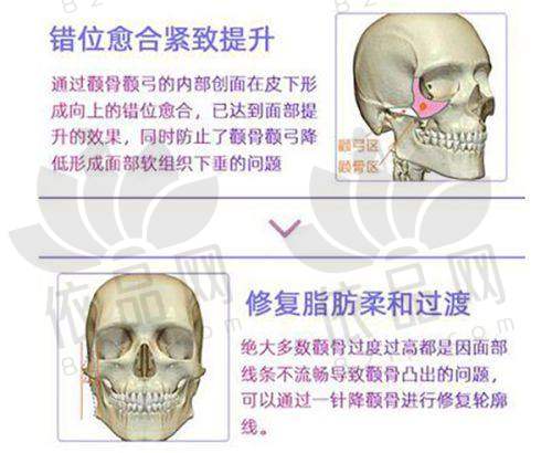 苏州维多利亚整形美容医院预约挂号