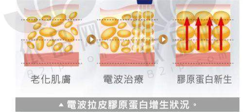 影响2025郑州玻尿酸注射价格的因素