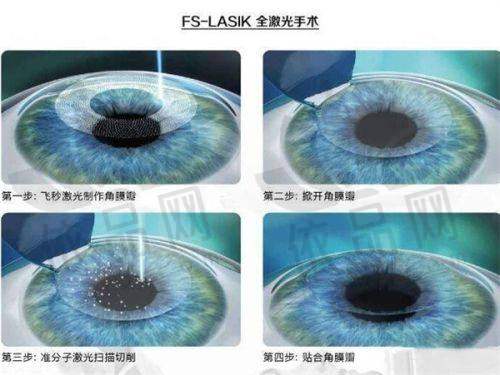 成都友华普惠眼科医院基本信息