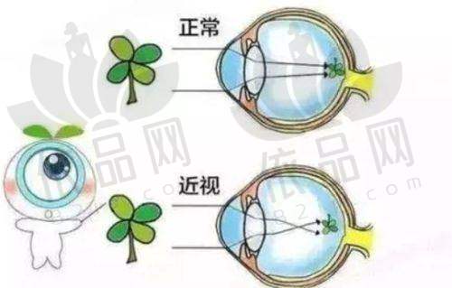 四、苏州光明眼科医院的独特治疗方法