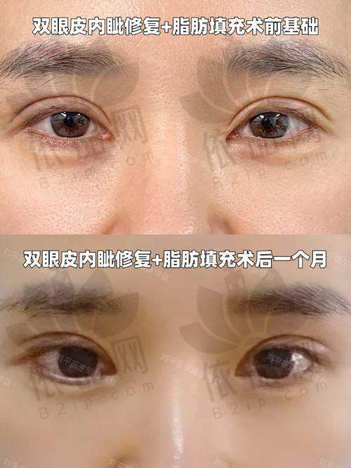 郑州眼修复医生排名