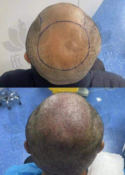 沈阳和平伍柒笙泽植发医疗美容诊所 营业时间