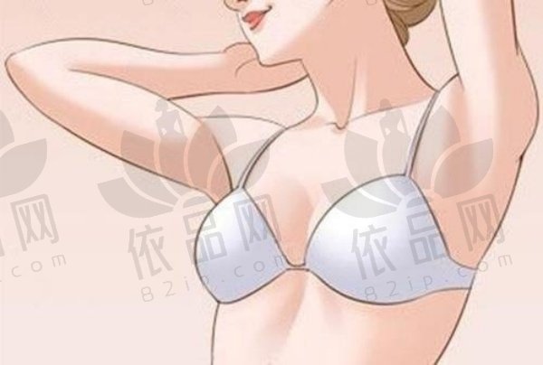 长春中妍赵胜有做假体隆胸25000元起，内窥镜技术，审美在线，口碑超棒