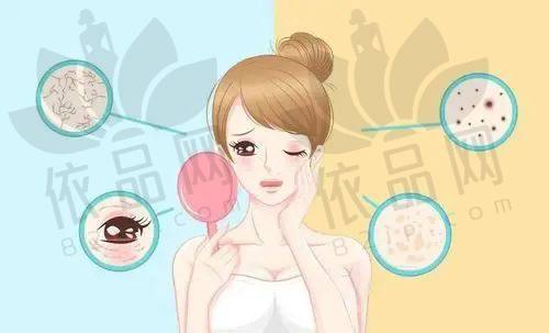 长春中妍光子嫩肤1500元起，7天见效，技术优体验好，还能去面部红血丝