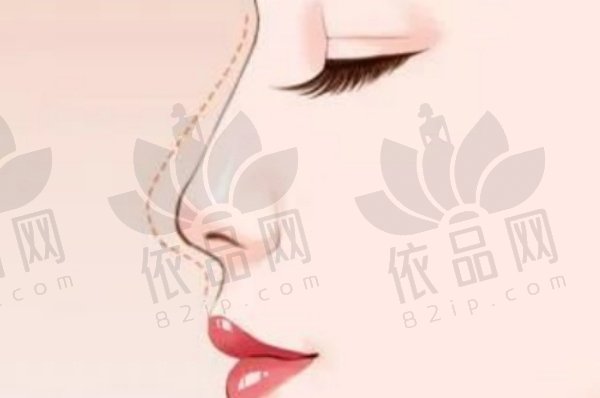 长春中妍胡海洋做鼻子18000元起，个性化方案+精细操作，术后形态自然满意度高！