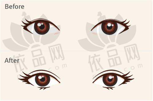北京联合丽格腰腹吸脂技术优势