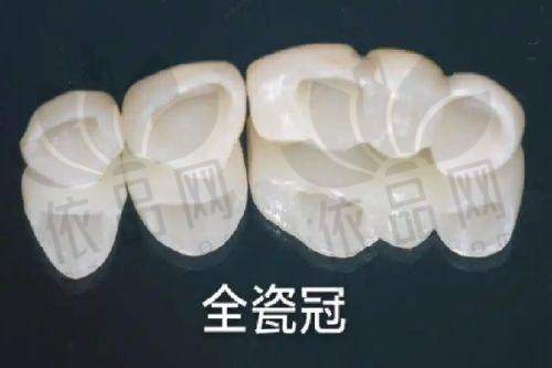 大连洁雅口腔何玉斌医生——特色技术优势