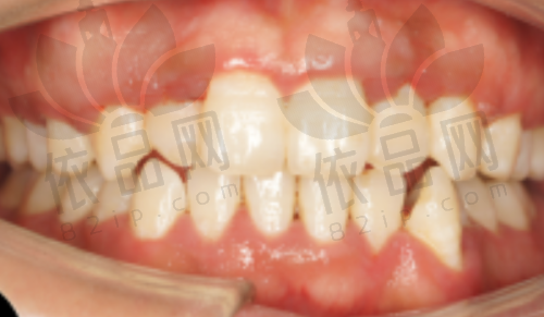 福州协和口腔中 心—综合服务一体化，种植牙项目火热