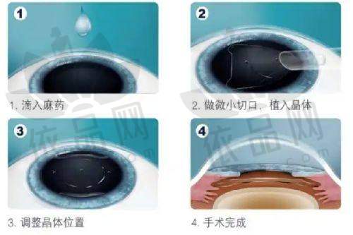 合肥东南眼科医院正规吗