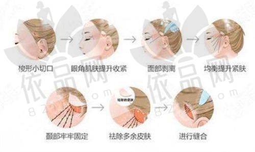 大连瑞和医疗美容门诊部预约方式