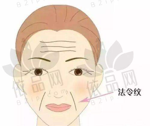 4、李青峰