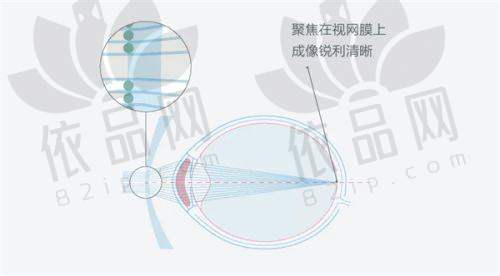 湛江爱尔眼科医院地址在哪里？地址电话、预约挂号一文详解，含具体信息及营业时间