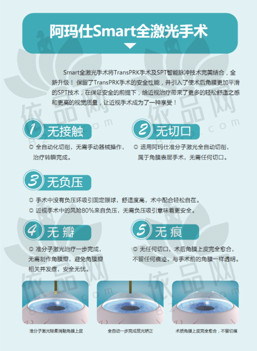 角膜塑形镜佩戴注意事项
