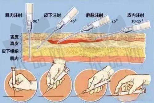 二、西 京医院微整形医生 - 董立维、宋保强