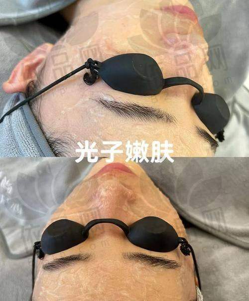 选择正规机构和专精医生