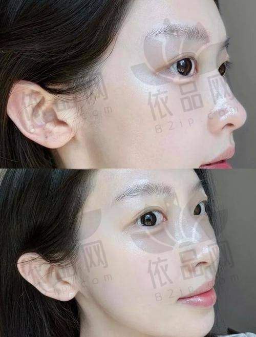 一、北京加减美整形医院