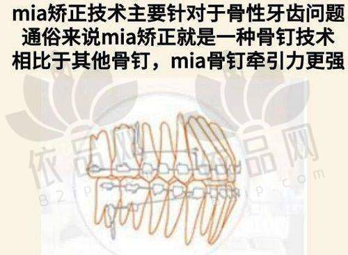 付德林医生技术优势