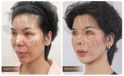 8、陈刚，坐诊医院：南京美贝尔美容医院