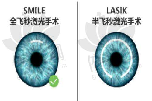 五、北京大学深圳医院眼科其他常见项目收费表（2025年新版）