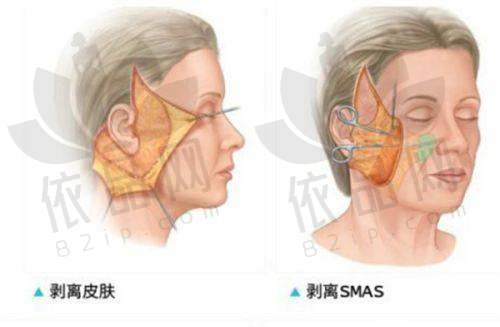2025成都美莱整形医院价目表曝光：双眼皮、隆鼻、隆胸价格大揭秘