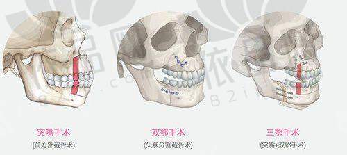 成都美莱7D聚拉缇的价格优势