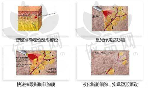 武汉亚韩整形外科医院特色项目