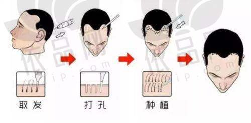 大连亲和医疗美容植发科预约方式