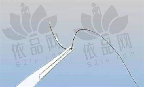 王晓斌医生注射除皱针的价格