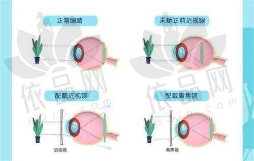 深圳黑马眼科：以其独特的医疗理念和优质的服务在眼科市场中崭露头角。黑马眼科专注于近视眼手术和眼科疾病的诊疗，采用了精良的技术和设备，为患者提供个性化的治疗方案。医院的医生团队具有丰富的临床经验，能够正确地诊断和治疗各种眼部疾病。此外，黑马眼科还注重患者的心理疏导，会在治疗过程中给予患者充分的关心和支持，让患者能够以积极的心态面对疾病。