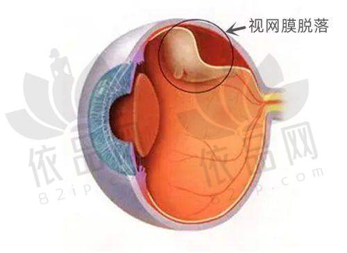 深圳友华普惠眼科：致力于为患者提供全方面的眼科医疗服务。在近视眼手术方面，友华普惠眼科有着独特的优势。医院采用了精良的手术技术，能够有效提高手术的安心性和有效性。同时，医院还注重 医疗质量的控制，严格遵守手术操作规范，确保每一位患者都能得到至佳的治疗成效。除了近视眼手术，友华普惠眼科还开展了其他眼科疾病的诊疗服务，如白内障、青光眼等。