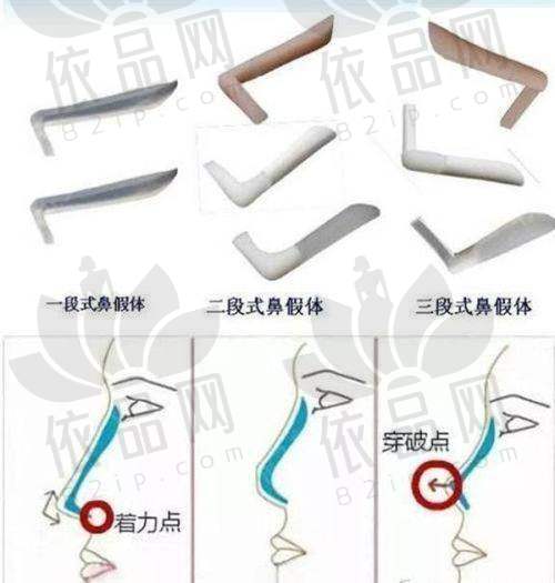 西安壹加壹医疗美容医院：平价亲民，适合预算有限人群