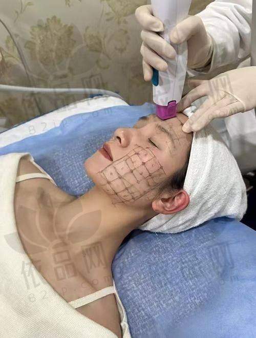 真人实例见证合肥艺星热玛吉成效