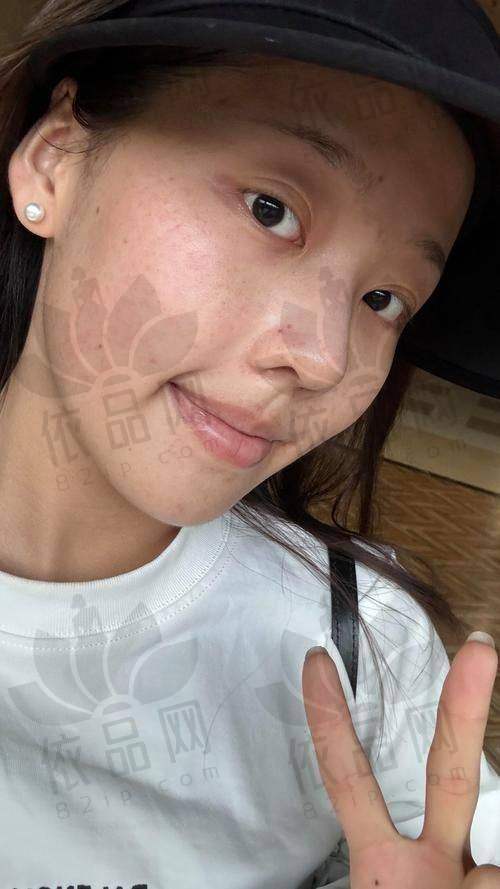 合肥艺星医疗美容医院怎么样