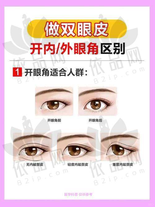 武汉亚韩整形医院双眼皮手术的优势总结
