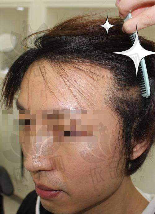 大连亲和医疗美容植发科正规吗