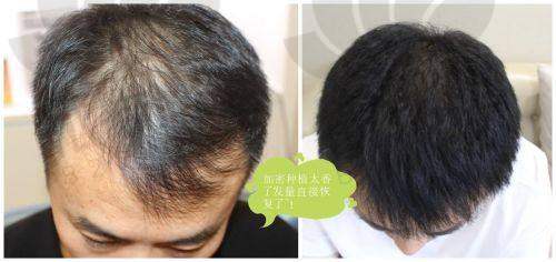 大连亲和医疗美容植发科收费价格表
