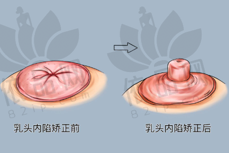 丹东富雅华医医疗美容诊所正规吗