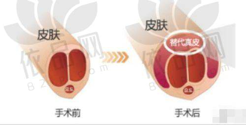 青岛大学附属医院医学美容科：陈振雨