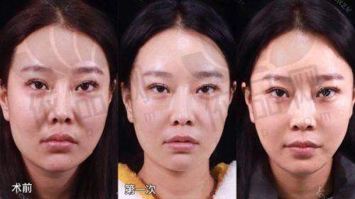 河南中医药大学第一附属医院美容科上班时间