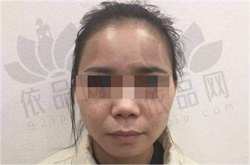 抚顺博爱医美郭冲医生 - 擅长项目